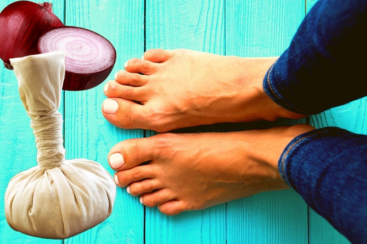 Can You Use Onion Poultice On Feet? Green Living Zone